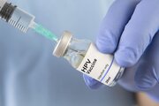 هشدار یک متخصص درباره افزایش ابتلا به ویروس HPV/ سن مراجعه به ۱۶ سال رسید